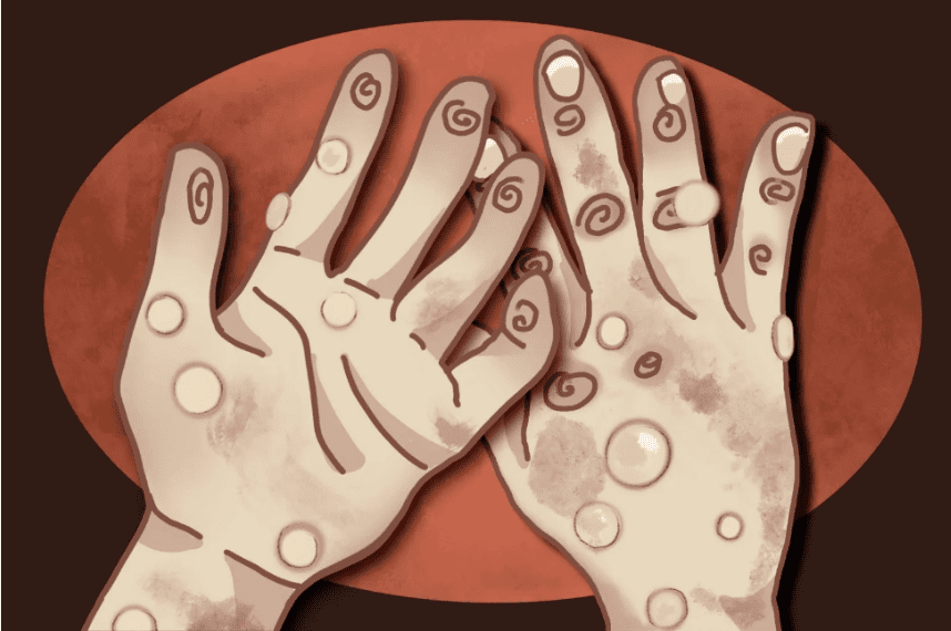 hands